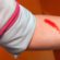 First aid for bleeding or injury - everything you need to know and do in this situation